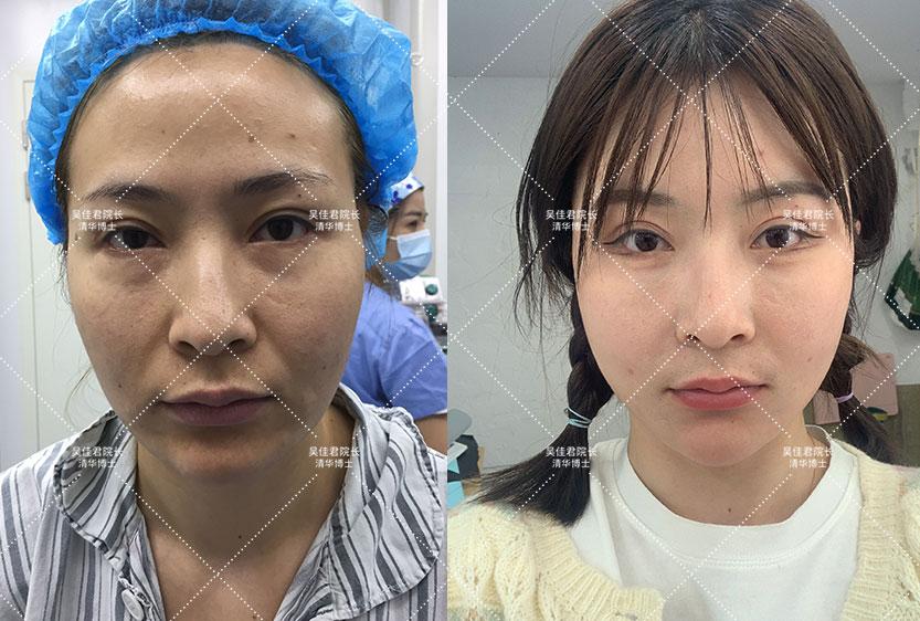 临猗_新澳门四肖期期准免费,揭露自动化仔细释义、解释与落实